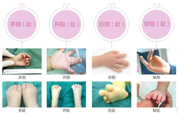 咖啡斑最新治疗技术详解，步骤解析与操作指南全攻略